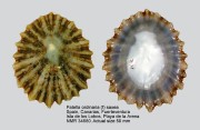 Patella ordinaria